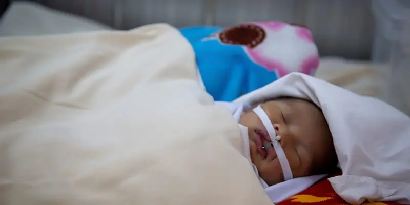 Born With A Cleft In Cambodia Narith's Story